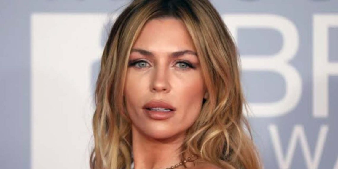 Abbey Clancy's Musical Throwback: A Moment of Embarrassment – OtakuKart ...